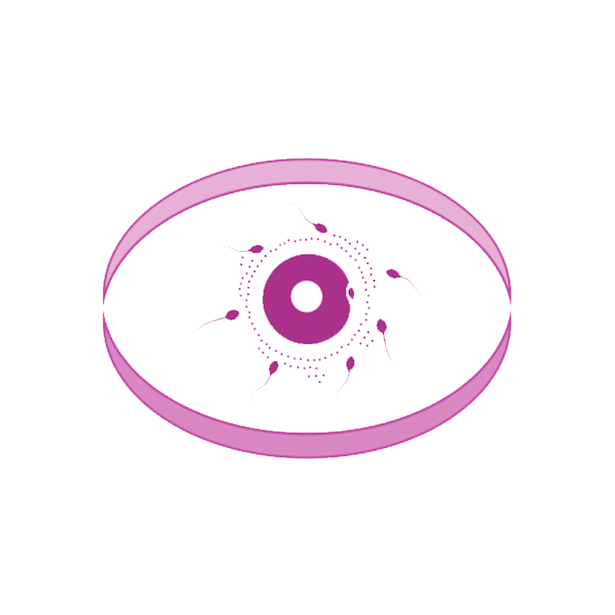 Ghandi fertilite centre