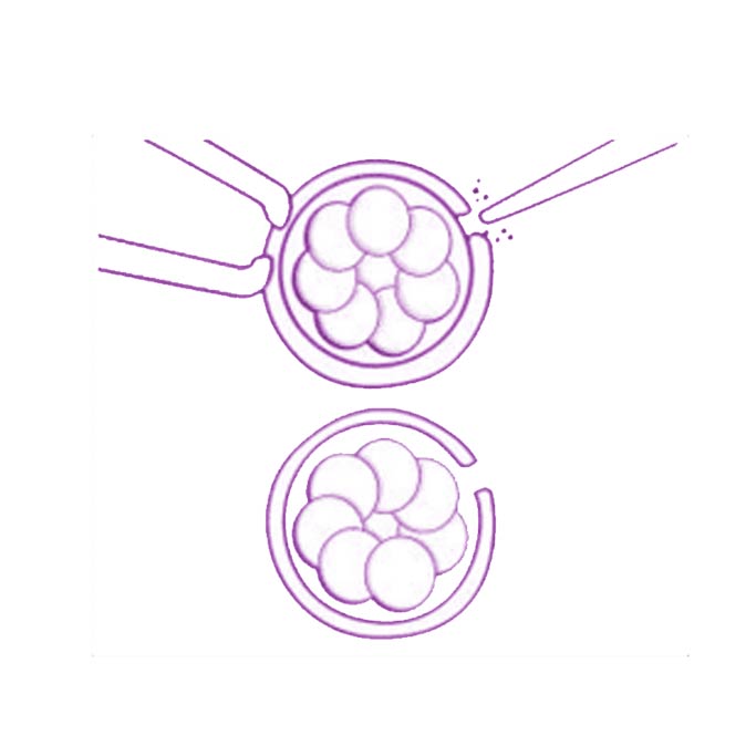 Ghandi fertilite centre
